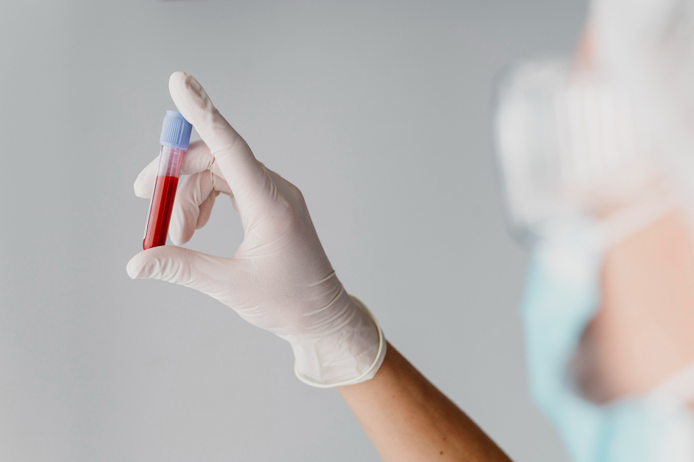 /upl/back-view-doctor-holding-a-blood-sample.jpg